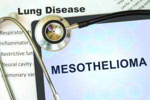 Mesothelioma Attorney in Maryland